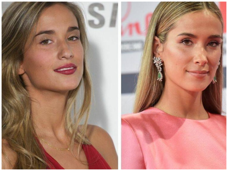 maria pombo antes y despues
